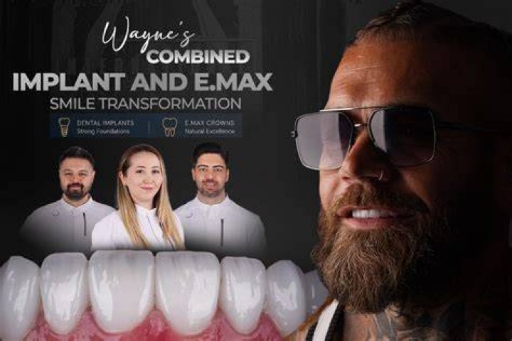 Complete smile transformation!! Created on the Gold Coast with Layered