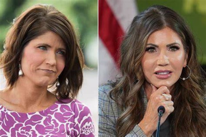 Kristi Noem&rsquo;s Plastic Surgery Couldn&rsquo;t Be More Obvious to Viewers in