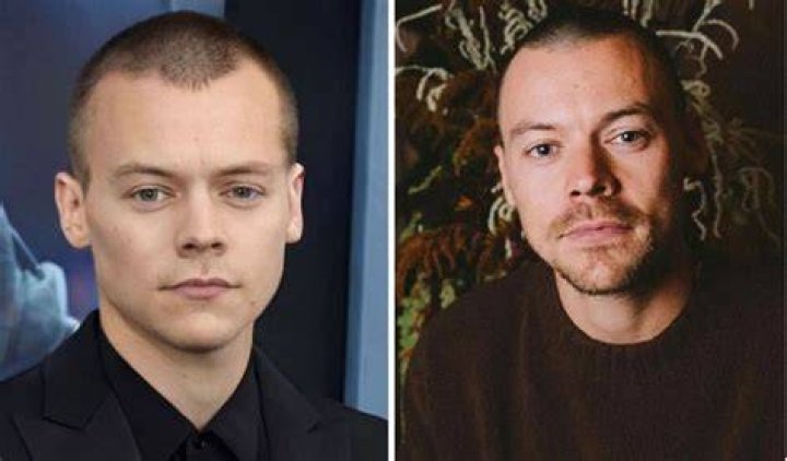 Unveiling Harry Styles' Bald Revelation: Inside The Bold Transformation